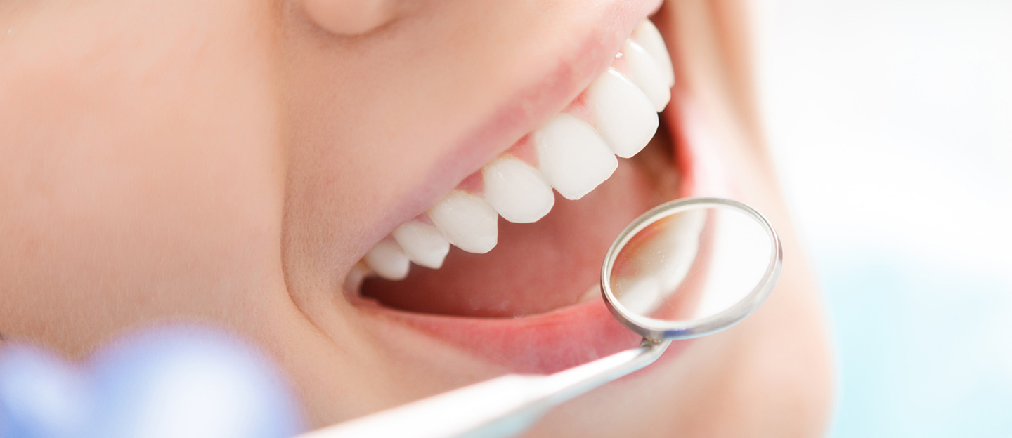 Unser Wissen für Ihre Zähne - Professionelle Zahnreinigung